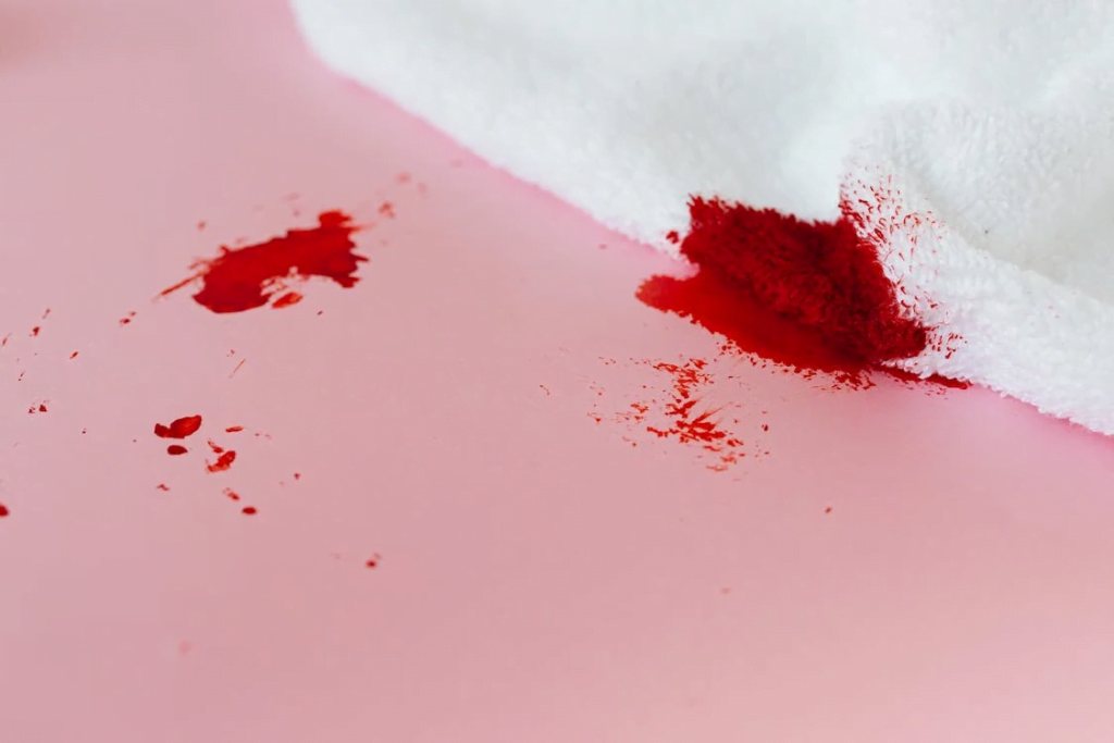 Red Alert: The Truth About the Color of Period Blood